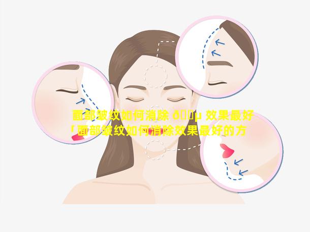 面部皱纹如何消除 🌵 效果最好「面部皱纹如何消除效果最好的方法」